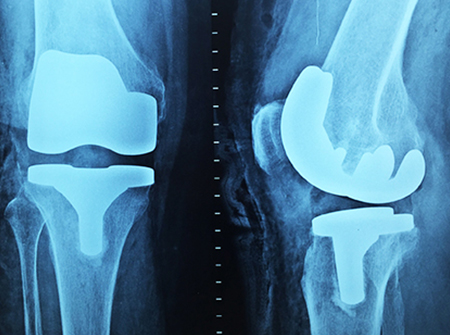 Orthopädische Chirurgie